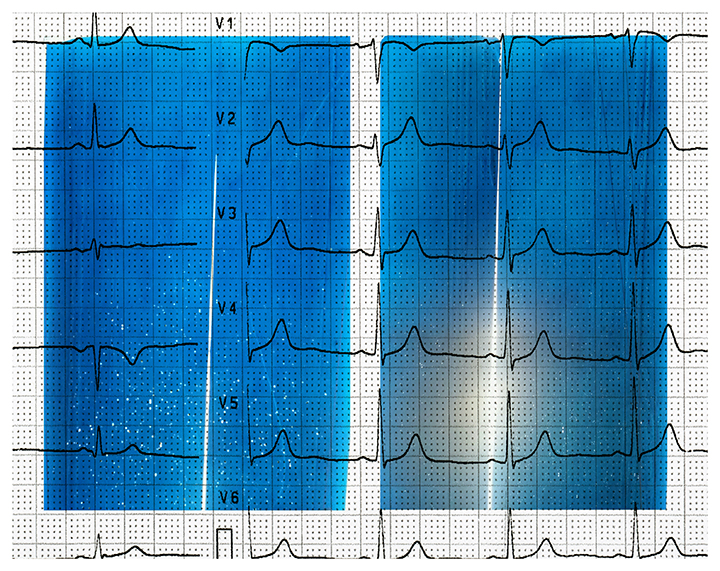 Blue Screening-withheart&amp;soul 2